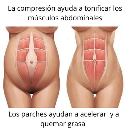 Faja Reductora (GRATIS Parches Adelgazantes)